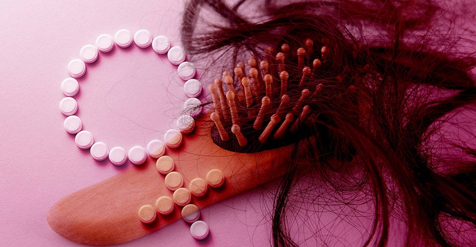 آیا کنترل بارداری می‌تواند باعث ریزش مو شود؟