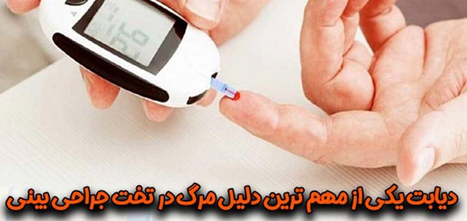 جراحی بینی و محدودیت آن برای افراد دیابتی