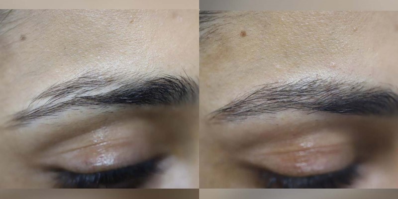 5 نکته مهم درباره کاشت ابرو که باید بدانید