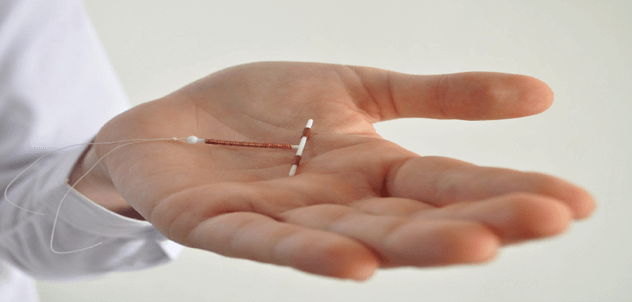 آی یو دی (IUD) چیست؟
