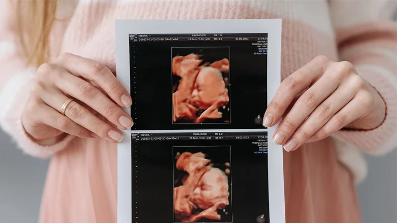 همه چیز درباره سونوگرافی داپلر