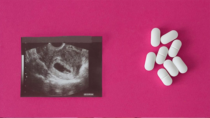 نشانه‌های تهدید به سقط جنین