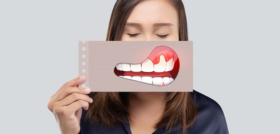 علائم هشدار دهنده سرطان دهان