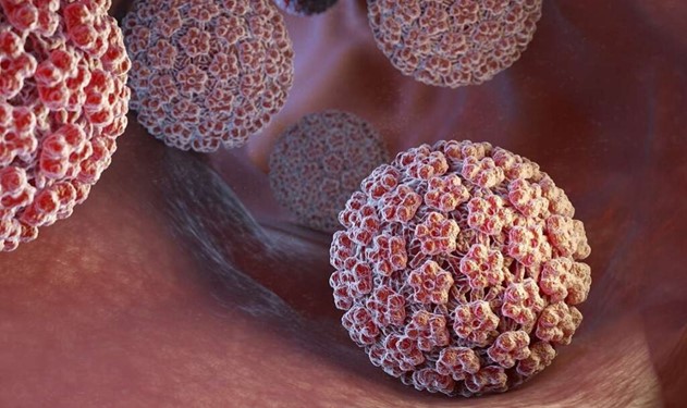 ویروس HPV یا زگیل تناسلی