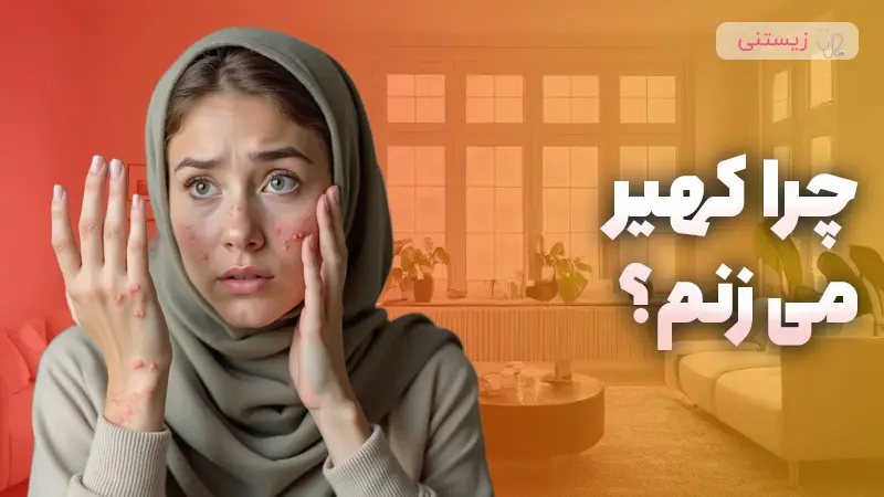 علت ابتلا به کهیر پوستی