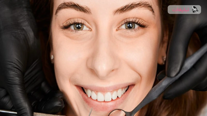 راز لبخند زیبا: نگاهی تخصصی به لمینت دندان با دکتر قاسم‌نژاد