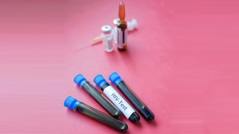 تست خانگی HIV؛ گام بزرگ لندن برای حذف موارد جدید تا ۲۰۳۰