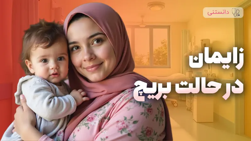 زایمان در حالت بریچ (Breech) و روشهای مدیریت
