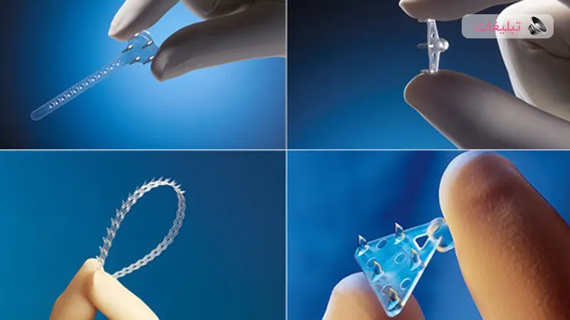 لیفت صورت دائمی با استفاده از اندوتاین و اندوسکوپی