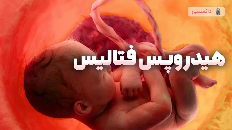 علل و درمان خیز جنینی