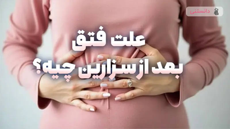 علت فتق بعد از سزارین چیه؟