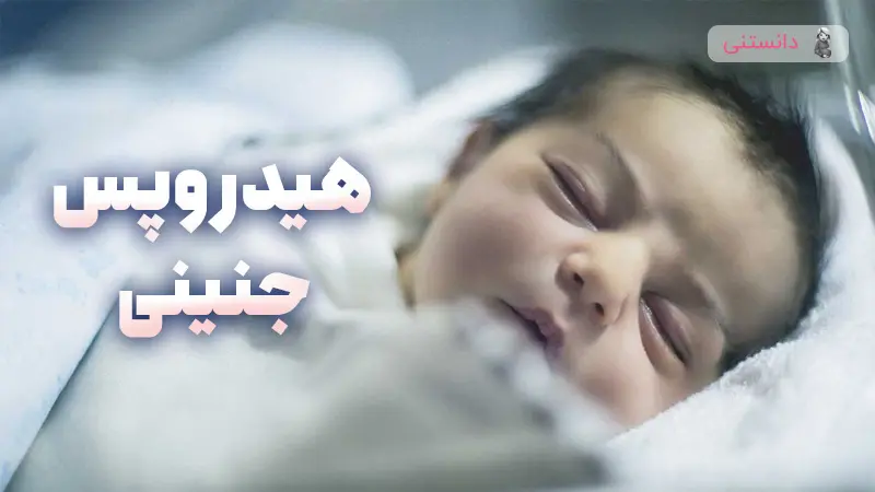 هیدروپس جنینی چیست؟ تشخیص و درمان در بارداری