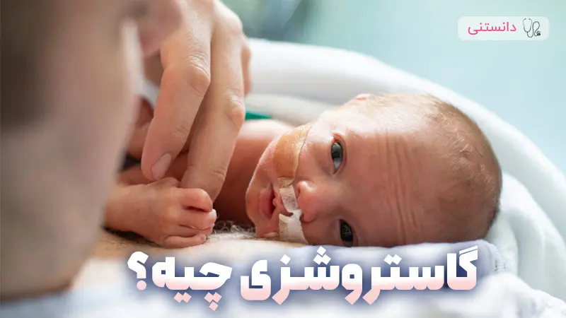 گاستروشزی چیه؟