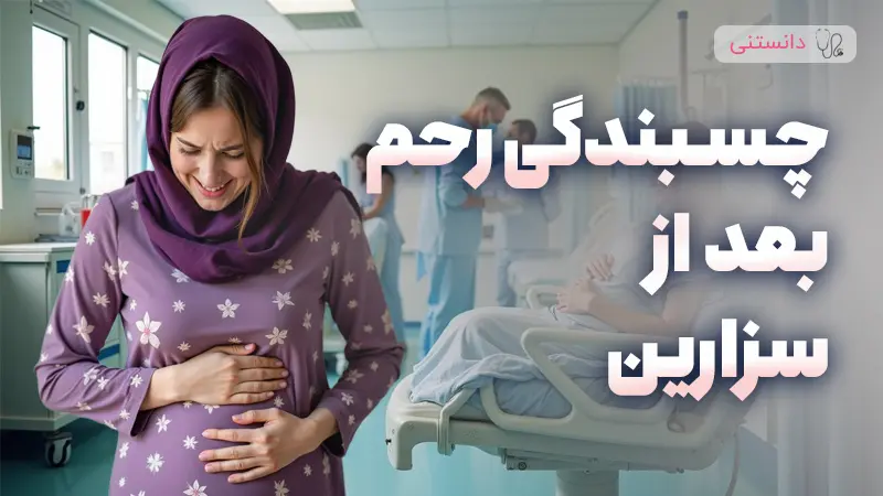 نقش سزارین در ایجاد چسبندگیهای رحم