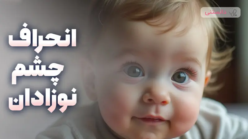 انحراف چشم نوزادان تا چند ماهگی طبیعیه؟