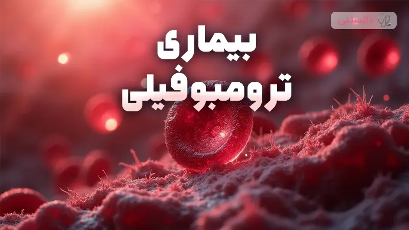 بیماری ترومبوفیلی چیه و چگونه درمان میشه؟