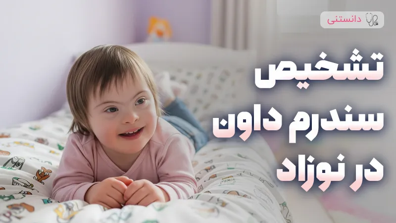 شیوههای تشخیص سندروم داون در نوزاد