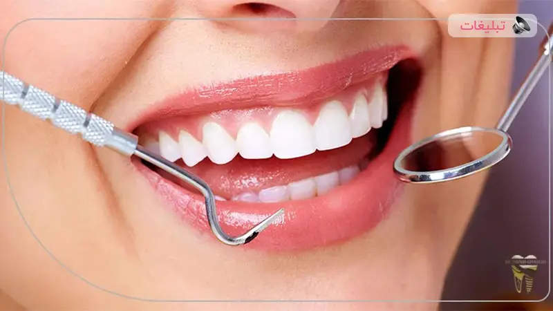 دکتر قاسمی اولین متخصص لمینت دندان به صورت دیجیتال در شیراز