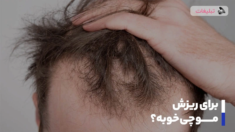 برای ریزش مو چی خوبه؟ ویتامین‌ها، شامپوها، قرص‌ها