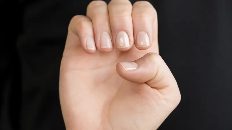 شکنندگی ناخن‌ها؛علل، عوامل مؤثر و راه‌های درمان