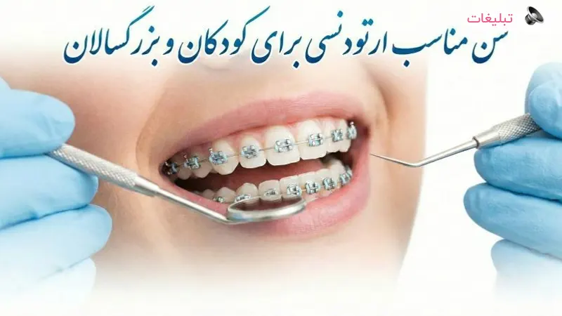 سن مناسب ارتودنسی برای کودکان و بزرگسالان