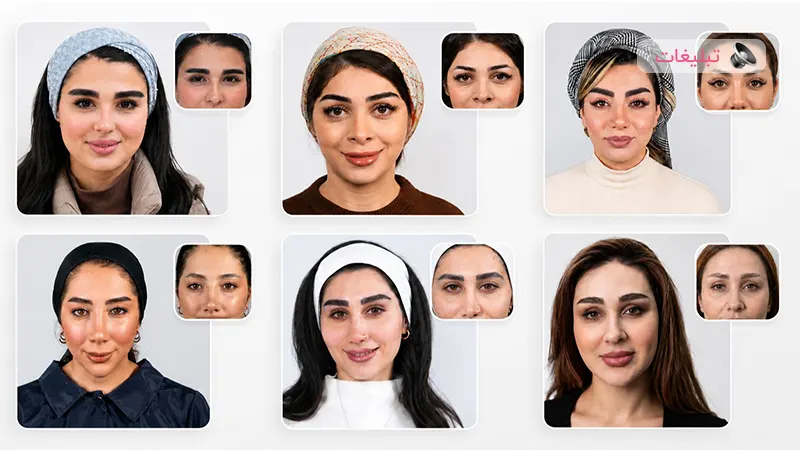 کاشت ابرو چقدر می‌تواند چهره را تغییر دهد؟ تصاویر واقعی قبل و بعد را ببینید